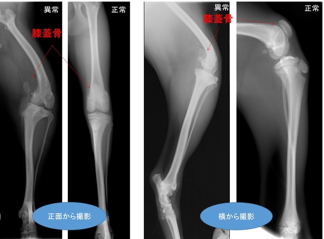 膝蓋骨内方脱臼（グレードⅣ）