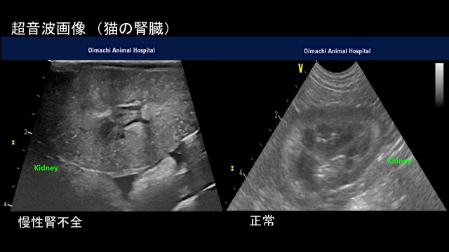 慢性腎不全